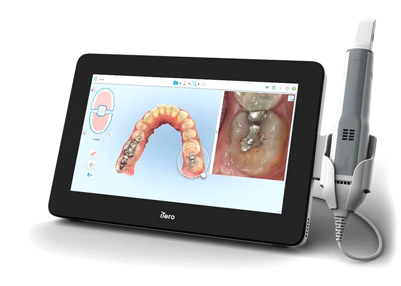 iTero scanner and output