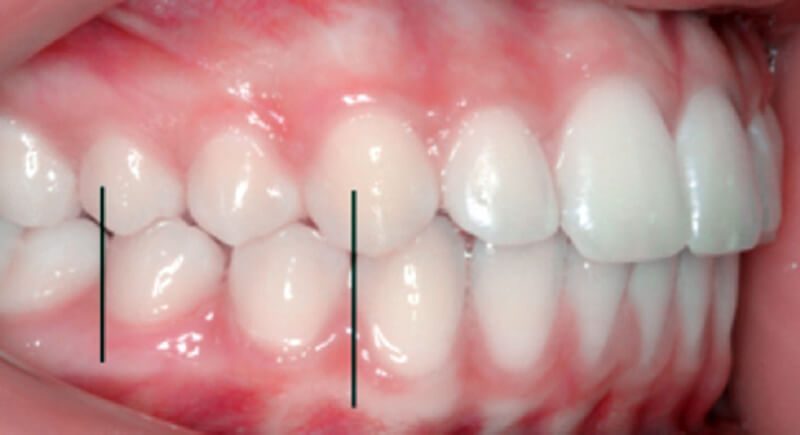 final treatment results