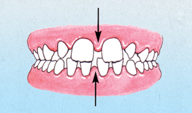 diagram of Spacing