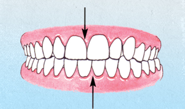diagram of Unmatched Midlines