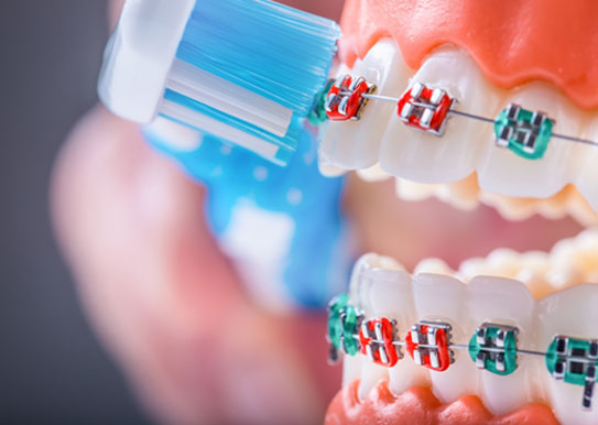 closeup of a toothbrush and braces with red and green elastics